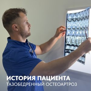 История пациента тазобедренный остеоартроз